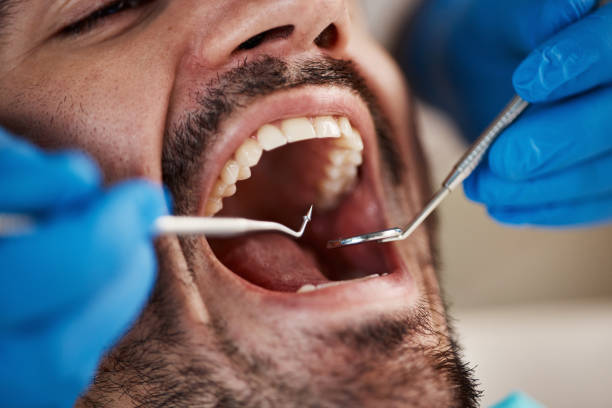 Best Periodontal (Gum) Disease Treatment  in Midway South, TX